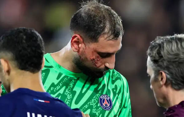 多納魯馬面部受傷后，巴黎圣日耳曼更新最新?tīng)顩r